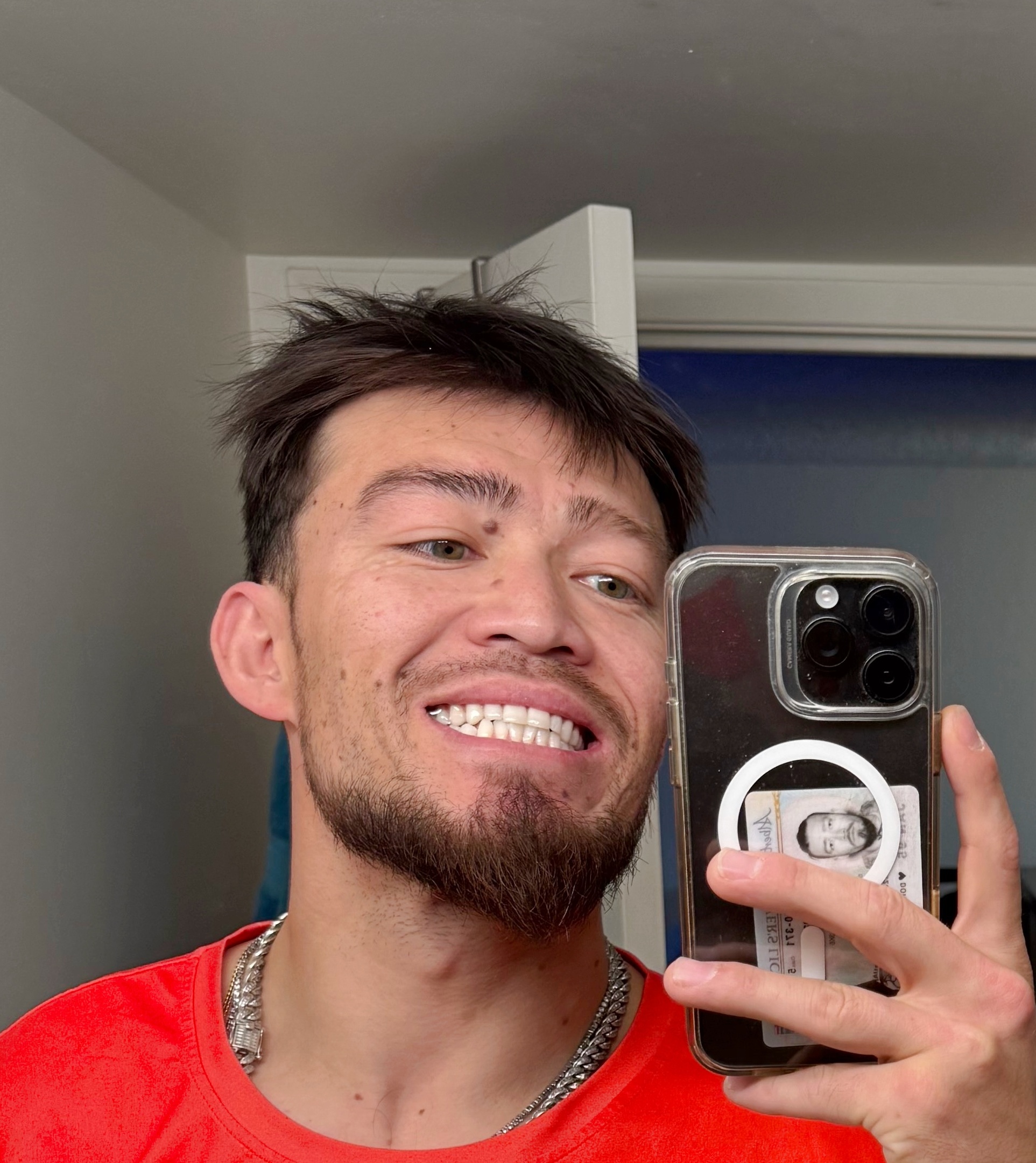 Teeth Whitening